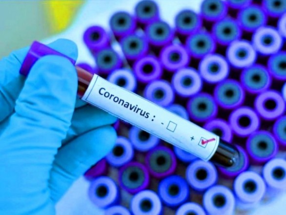 В Казахстане зарегистрировано еще 5 случаев заражения коронавирусом