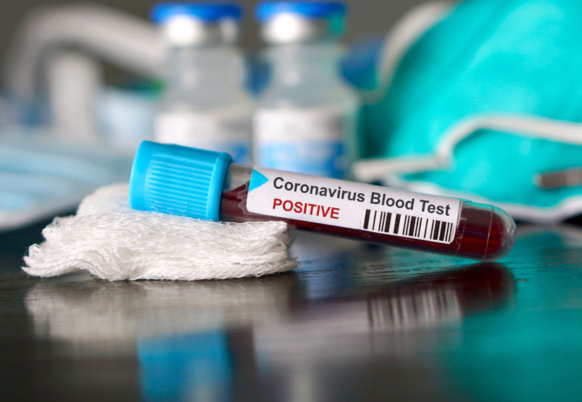 В Казахстане выявлено 22 новых случая заражения коронавирусом