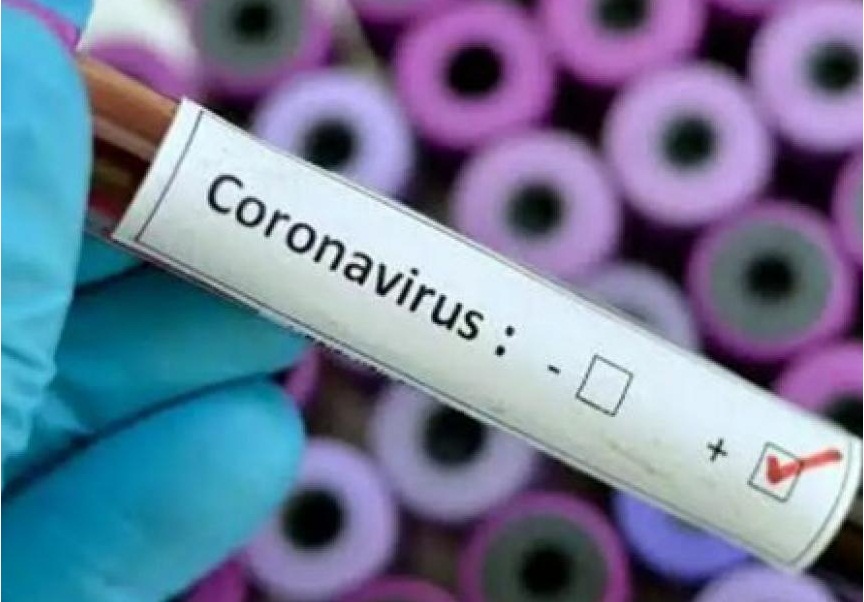 В Казахстане выявлены 3988 больных коронавирусом