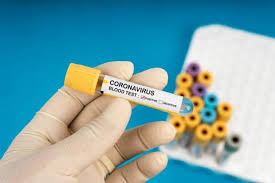 Коронавирусом в Казахстане заражены 4509 человек