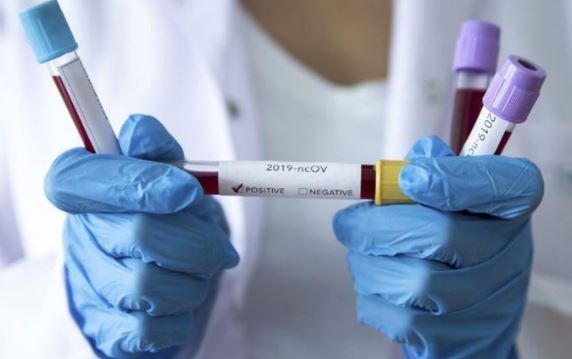 В Казахстане выявлены еще 173 заболевших коронавирусной инфекцией