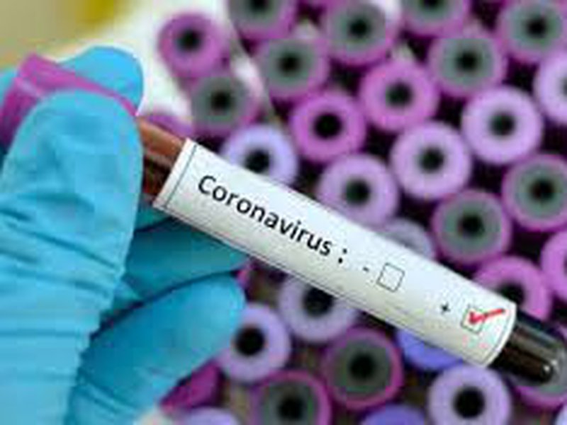 В Казахстане зарегистрировано более 300 случаев заражения коронавирусом