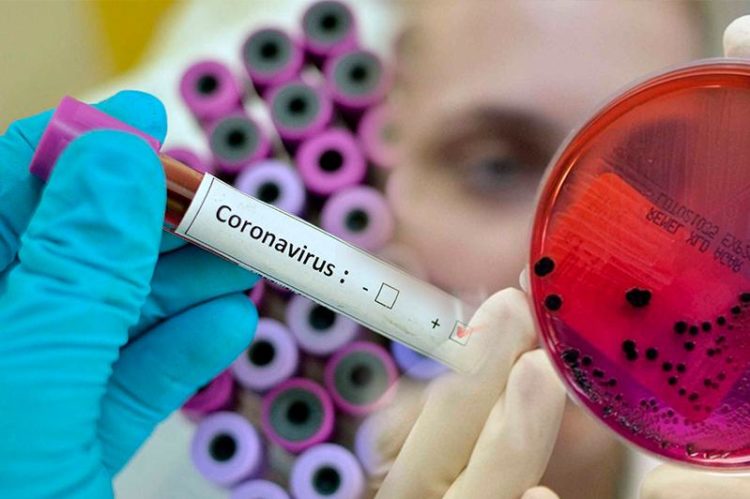 Зарегистрировано еще 68 случаев заражения коронавирусом