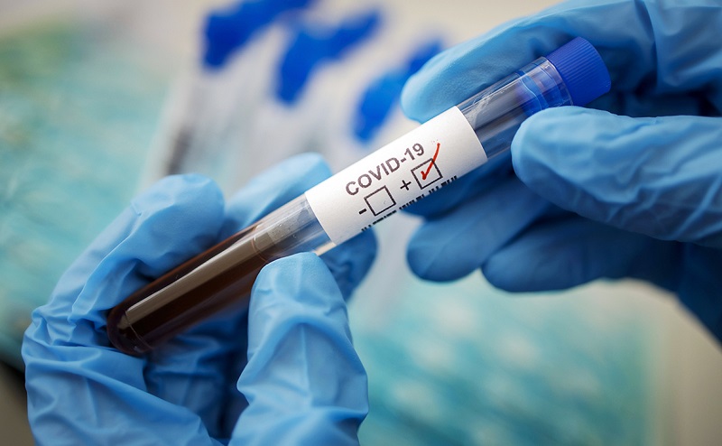 В Казахстане зарегистрированы еще 67 зараженных коронавирусом человек