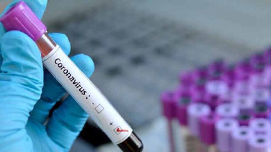 В Алматы станут делать ежесуточно до 2,5 – 3 тысяч тестов на коронавирус