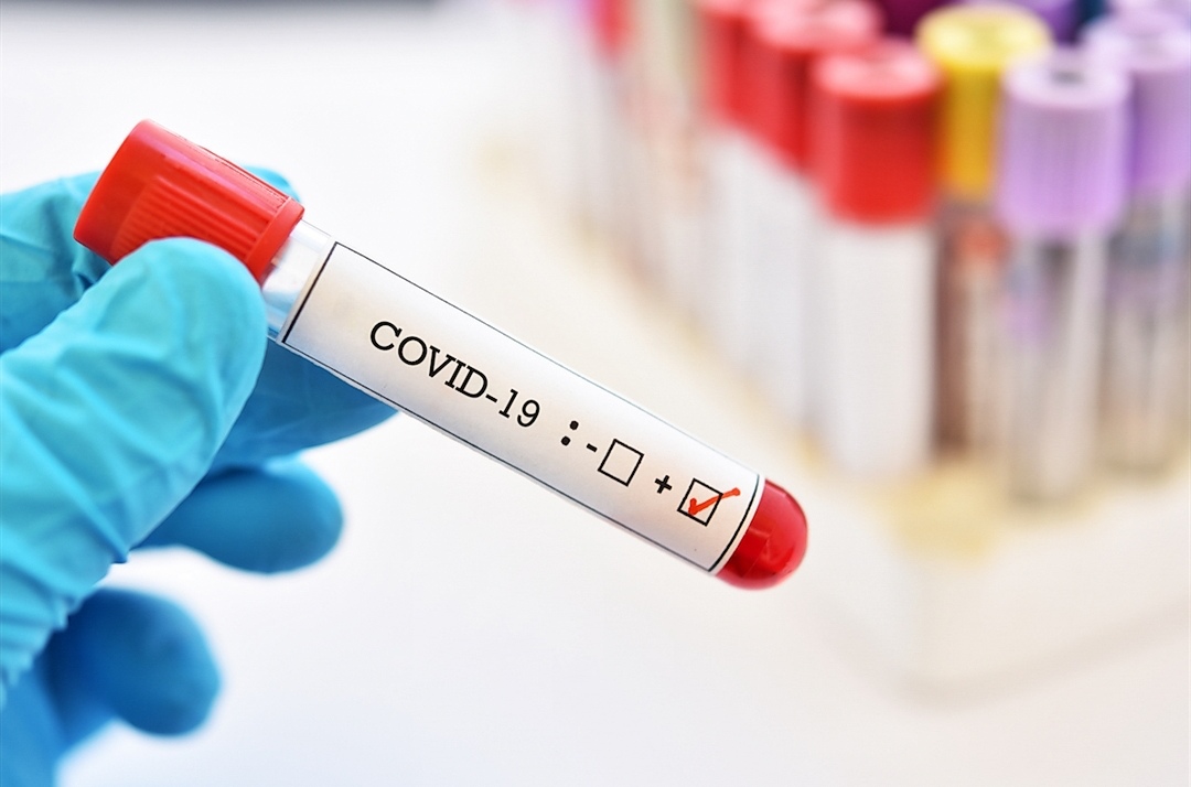 Зарегистрировано еще 39 случаев заболевания коронавирусом