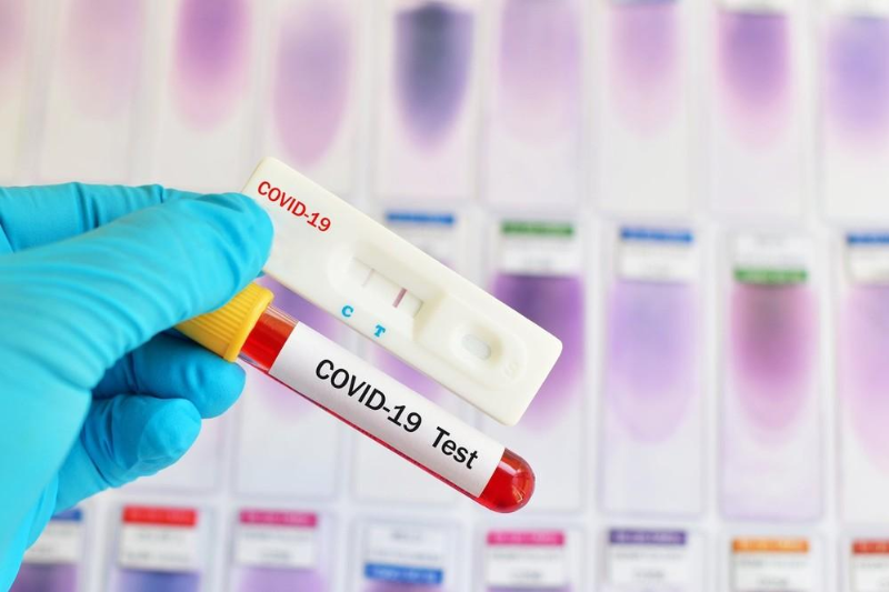 За минувшие сутки 118 человек инфицированы коронавирусом